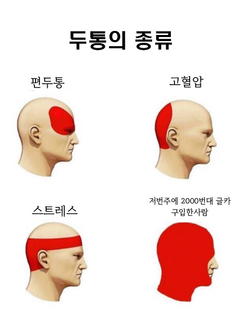 두통의 종류