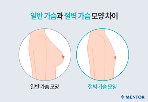 판) 가슴 절벽인 언니 있어요?