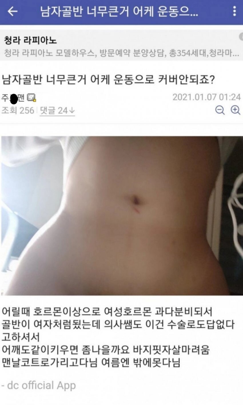 골반이 너무 커서 고민