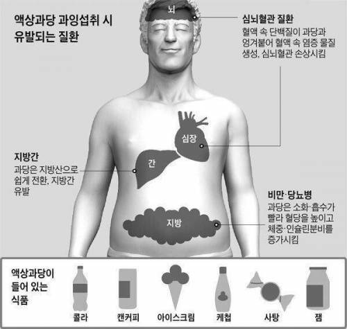 요즘 현대인들 비만 원인 1순위